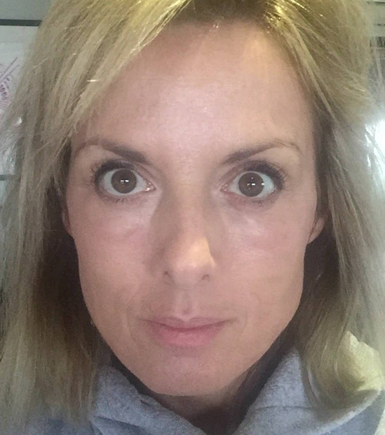 Skin rejuvenation — The morning after — with light makeup